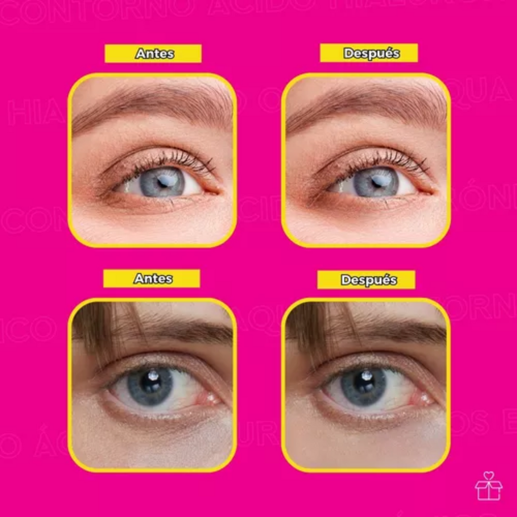 Crema Para Contorno De Ojos De Ácido Hialuronico Anti Edad OnlyShop Mexico