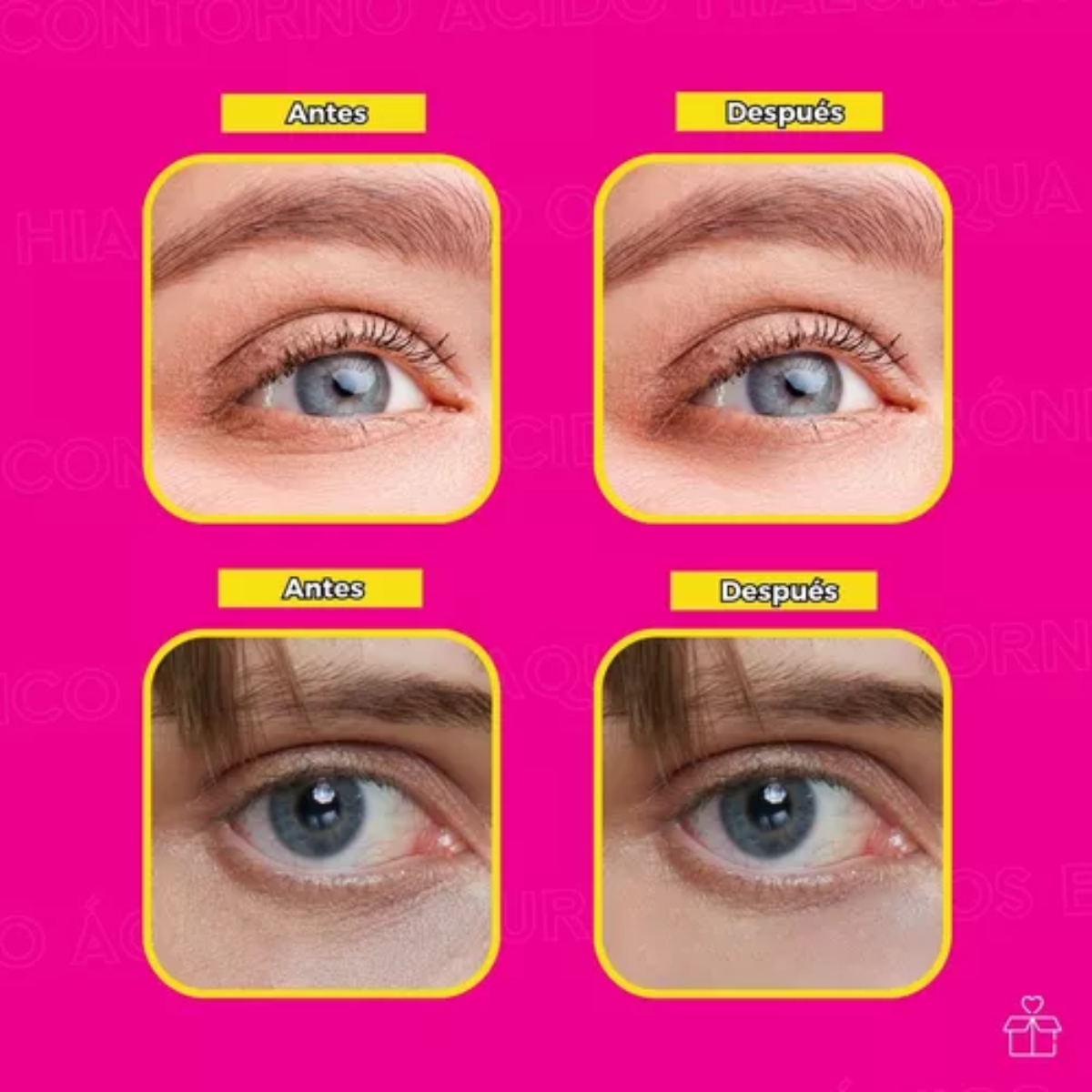 Crema Para Contorno De Ojos De Ácido Hialuronico Anti Edad OnlyShop Mexico